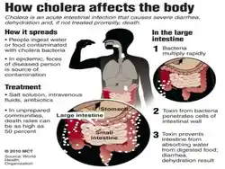 Facts about cholera.