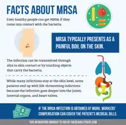 Facts about MRSA.