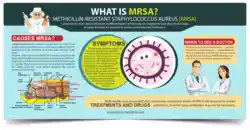 MRSA infographic.