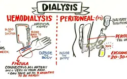 Two types of dialysis.