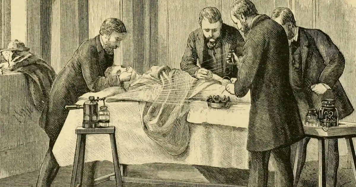 Joseph Lister's antisepsis, where the areas were prepped before surgery