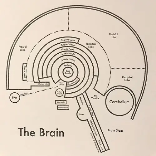 Simplified brain image